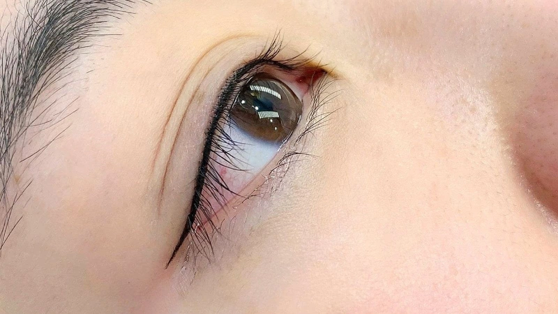 Phun mí mở tròng giúp đôi mắt to tròn long lanh hơn